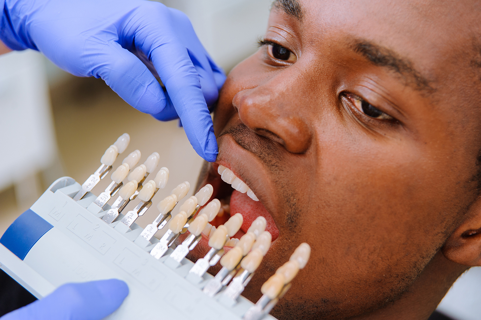 A person wearing gloves is operating a dental device on another individual s teeth, who appears to be experiencing discomfort or pain.