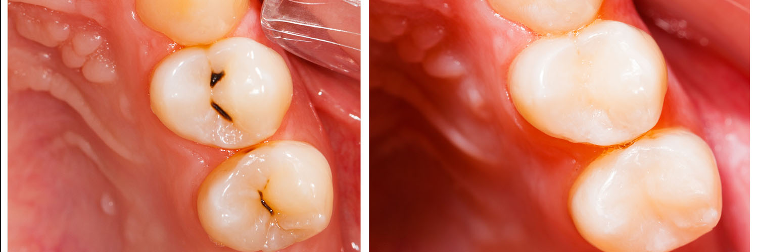 Elevate Dental